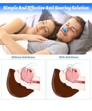 Aparat protiv hrkanja umetak za nos za hrkanje 777