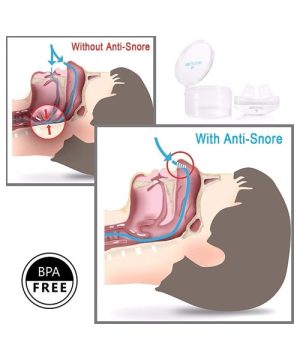 Aparat protiv hrkanja umetak za nos za hrkanje 333