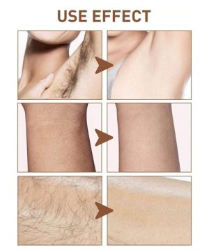 Krema Za Depilaciju krema za uklanjanje dlacica 99