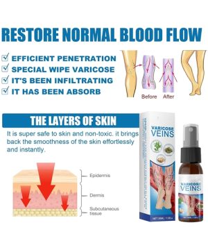 Sprej za proširene vene 99