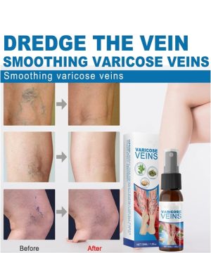 Sprej za proširene vene 77