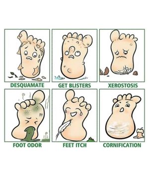 Sprej za stopala protiv gljivica 44